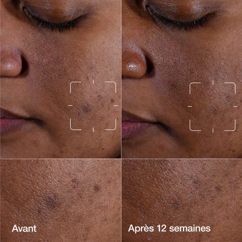 EVEN BETTER Even Better Clinical™ - Sérum Illuminateur Anti-taches 192333166925_2.jpg