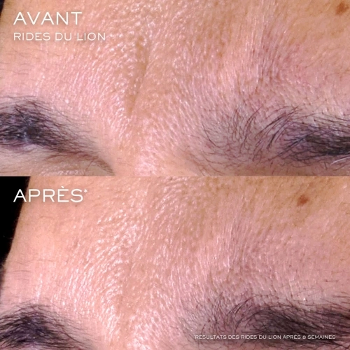 RENERGIE Facial serum 3614274368116_5.jpg