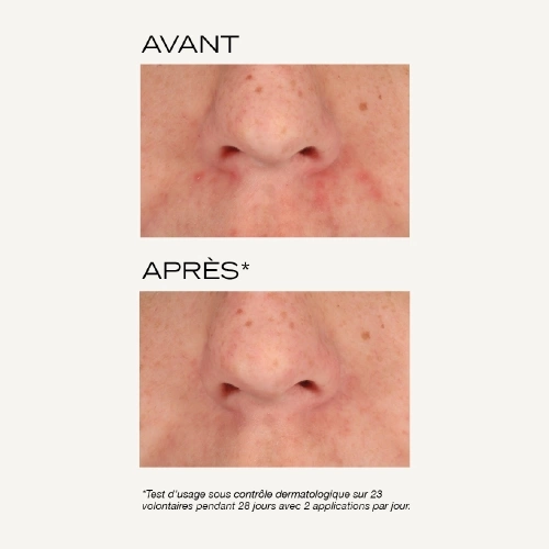 NUE Masque peeling intense 3390150597633_V4.png