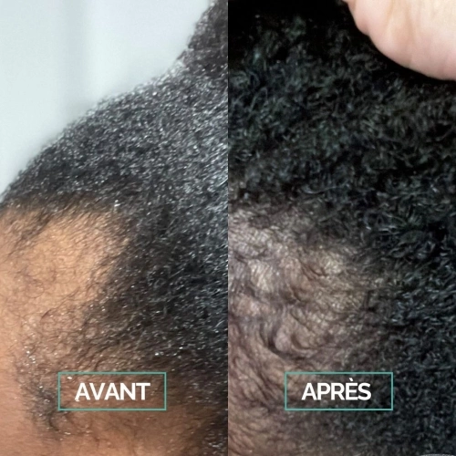 BOOST & SCALP Sérum Croissance 