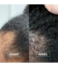BOOST & SCALP Serum Growth