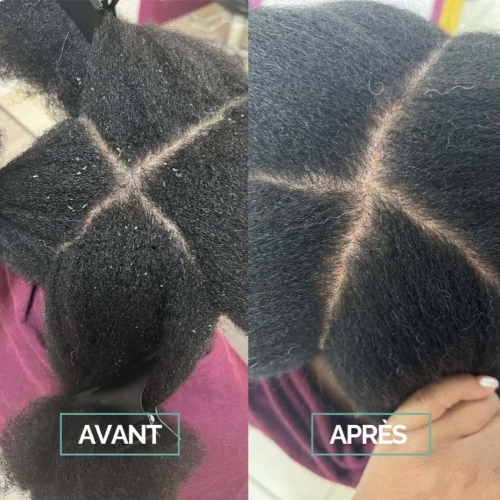 GELÉE DÉTOX Exfoliant Cuir Chevelu 