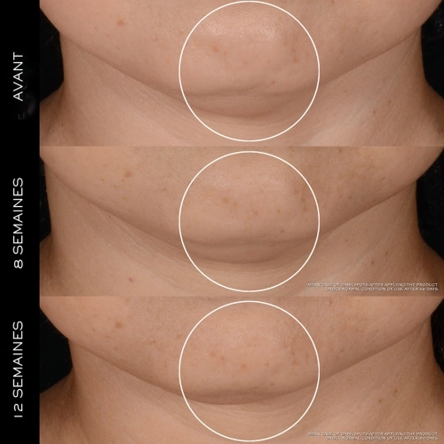 RÉNERGIE Coffret Crème Anti-âge 3614274772036_3.jpg