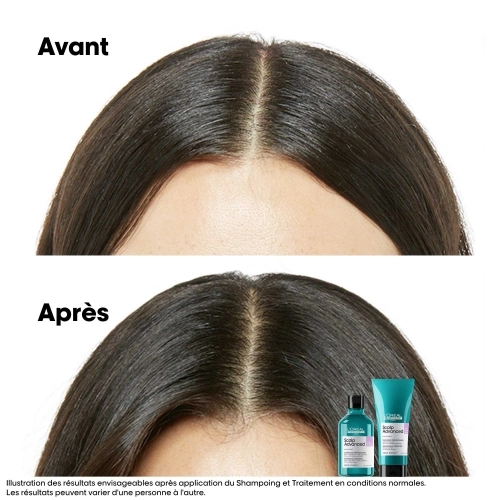 SCALP ADVANCED Traitement Anti-Inconfort, Apaisant & Hydratant 3474637090579_autre3.jpg