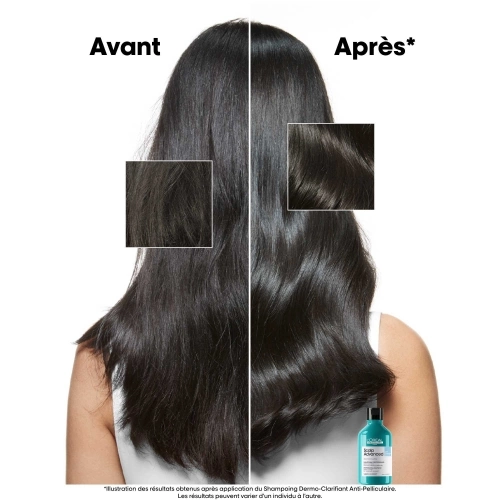 SCALP ADVANCED Shampoing Anti-Peliculles dermo-Clarifiant 3474637109370_autre3.jpg