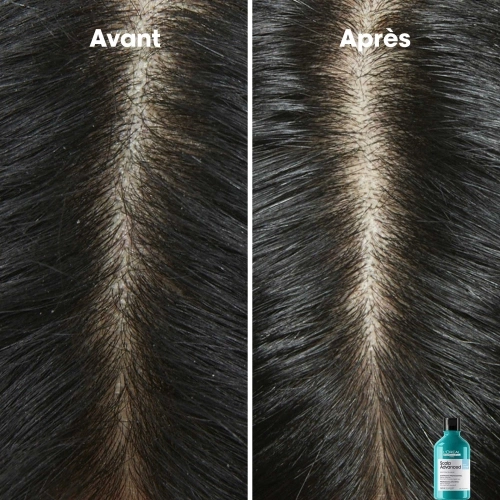 SCALP ADVANCED Shampoing Anti-Peliculles dermo-Clarifiant 3474637109370_autre4.jpg