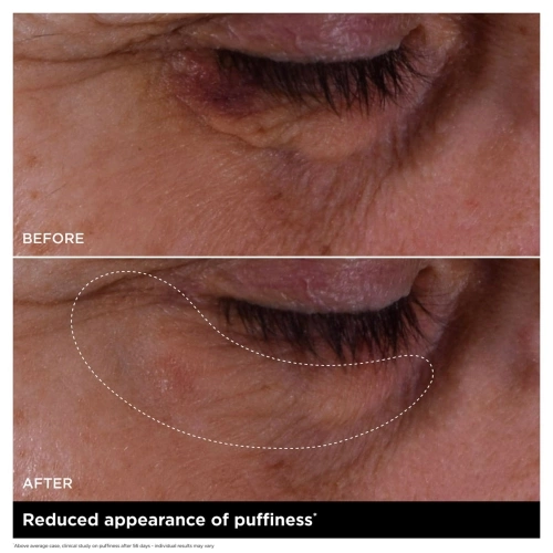 DOUBLE SERUM EYE Concentré yeux anti-âge complet 3666057382291_3.jpg