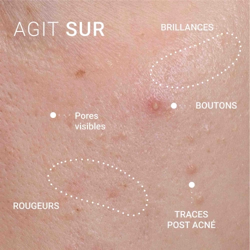 CORRECTIVE SERUM FOR SKIN WITH IMPERFECTIONS Correcting Serum for Blemish-Prone Skin 3473311271006_4.jpg