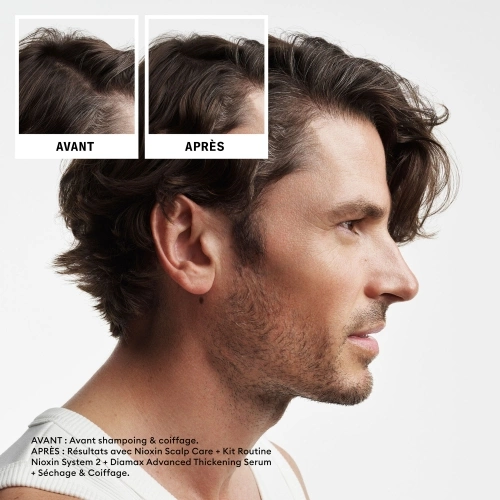 SYSTEM 2 Kit - System 2 pour cheveux naturels avec chute avancée 411.21_5.jpg