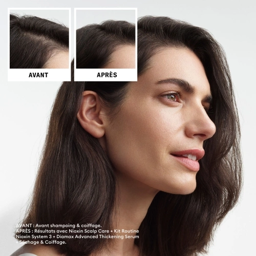 SYSTEM 3 Kit - System 3 for coloured, dry or damaged hair with moderate hair loss 411.31_5.jpg