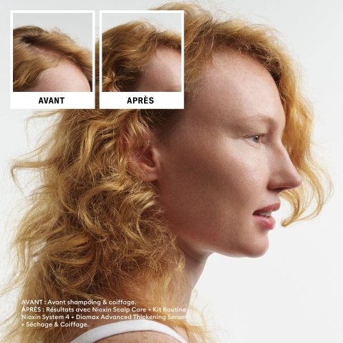 SYSTEM 4 Kit - System 4 pour cheveux colorés/secs/abîmés avec chute avancée 411.41_5.jpg