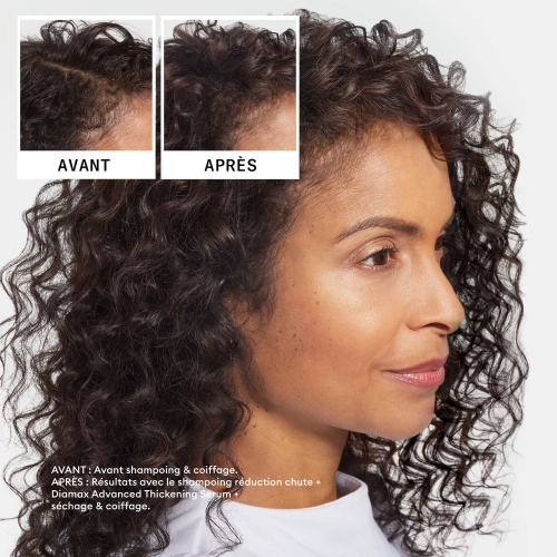 SOINS INTENSIFS - RÉDUCTION CHUTE Sandalore™ Hair Loss Reduction Shampoo – Intensive treatment to combat hair loss B0DFDLK56Q.PT05.jpg
