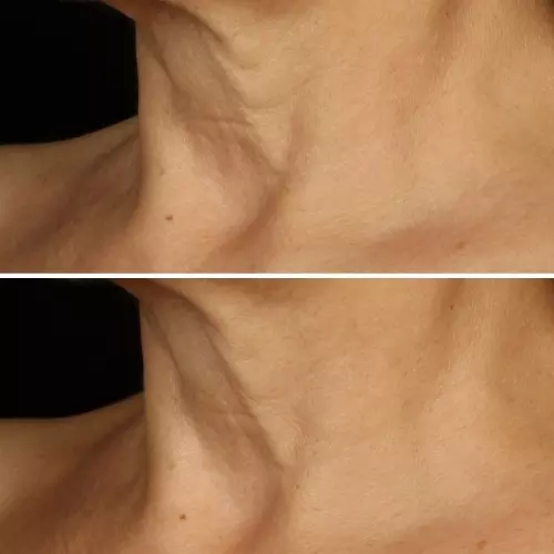 SMART CLINICAL Smart Clinical Repair™ Lift Cream Face + Neck 192333144756_5.jpg