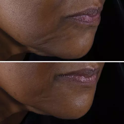 SMART CLINICAL Smart Clinical Repair™ Lift Cream Face + Neck 192333144756_3.jpg