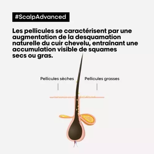 SHAMPOING SCALP ADVANCED ANTI-PELLICULAIRE Scalp Advanced 