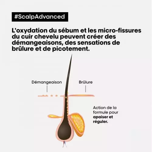 SHAMPOING ET MASQUE 2-EN-1 Scalp Advanced 