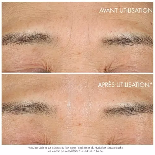 CAPTURE TOTALE HYALUSHOT Wrinkle corrector 3348901646086_3.jpg