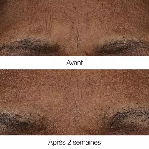 SMART CLINICAL REPAIR Smart Clinical Repair™ Baume rétinoïde anti-rides 192333232323_2.jpg